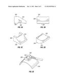 PHASED ARRAY ULTRASONIC EXAMINATION SYSTEM AND METHOD diagram and image