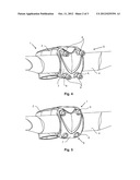 LIGHTWEIGHT MATERIAL, NOTABLY COMPOSITE MATERIAL, BICYCLE HANDLEBAR STEM diagram and image