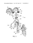 INSTRUMENT CARRIER WITH ARTICULATING BACK BRACE diagram and image