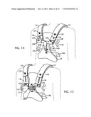 INSTRUMENT CARRIER WITH ARTICULATING BACK BRACE diagram and image