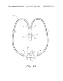 VENTILATION INTERFACE FOR SLEEP APNEA THERAPY diagram and image