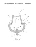 VENTILATION INTERFACE FOR SLEEP APNEA THERAPY diagram and image