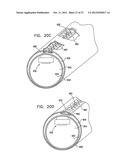 DRIP IRRIGATION APPARATUS diagram and image