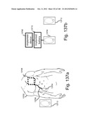 TUNABLE WIRELESS ENERGY TRANSFER FOR MEDICAL APPLICATIONS diagram and image