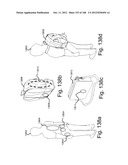 TUNABLE WIRELESS ENERGY TRANSFER FOR MEDICAL APPLICATIONS diagram and image