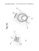 TUNABLE WIRELESS ENERGY TRANSFER FOR MEDICAL APPLICATIONS diagram and image