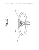 TUNABLE WIRELESS ENERGY TRANSFER FOR MEDICAL APPLICATIONS diagram and image