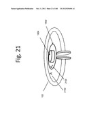 TUNABLE WIRELESS ENERGY TRANSFER FOR MEDICAL APPLICATIONS diagram and image