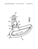 SIDE ARM RELEASE SYSTEM FOR EYEGLASS FRAME WITH CHANGEABLE TEMPLE PIECES diagram and image