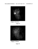 METHOD AND DEVICE FOR RETINAL IMAGE ANALYSIS diagram and image