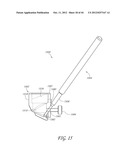 GONIOSCOPE FOR IMPROVED VIEWING diagram and image