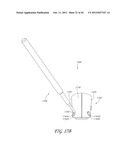 GONIOSCOPE FOR IMPROVED VIEWING diagram and image