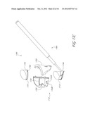 GONIOSCOPE FOR IMPROVED VIEWING diagram and image