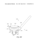 GONIOSCOPE FOR IMPROVED VIEWING diagram and image