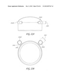 GONIOSCOPE FOR IMPROVED VIEWING diagram and image