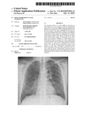 BONE SUPPRESSION IN X-RAY RADIOGRAMS diagram and image