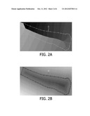 BONE SUPPRESSION IN X-RAY RADIOGRAMS diagram and image