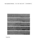 COMPOUNDS AND METHODS FOR THE TREATMENT OF RENAL DISEASE diagram and image