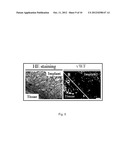 METHOD FOR INHIBITING ANGIOGENESIS diagram and image