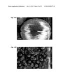 MICROCAPSULES COMPRISING BENZOYL PEROXIDE AND TOPICAL COMPOSITIONS     COMPRISING THEM diagram and image