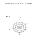 DEMINERALIZED BONE MATRIX COMPOSITIONS AND METHODS diagram and image