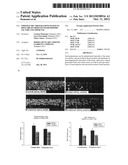 OPHTHALMIC PREPARATIONS BASED ON BDNF (BRAIN-DERIVED NEUROTROPHIC FACTOR)     AND THEIR USE diagram and image