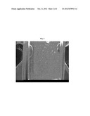 FORMULATIONS OF DEOXYCHOLIC ACID AND SALTS THEREOF diagram and image