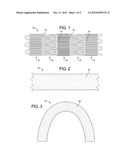 METHOD FOR MAKING A FLEXIBLE STENT-GRAFT diagram and image
