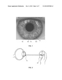 Flexible Eye Insert and Glucose Measuring System diagram and image