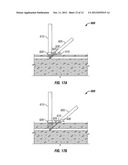 SYSTEMS AND METHODS FOR ACCESSING THE LUMEN OF A VESSEL diagram and image