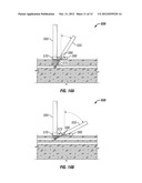 MOTORIZED SYSTEMS AND METHODS FOR ACCESSING THE LUMEN OF A VESSEL diagram and image