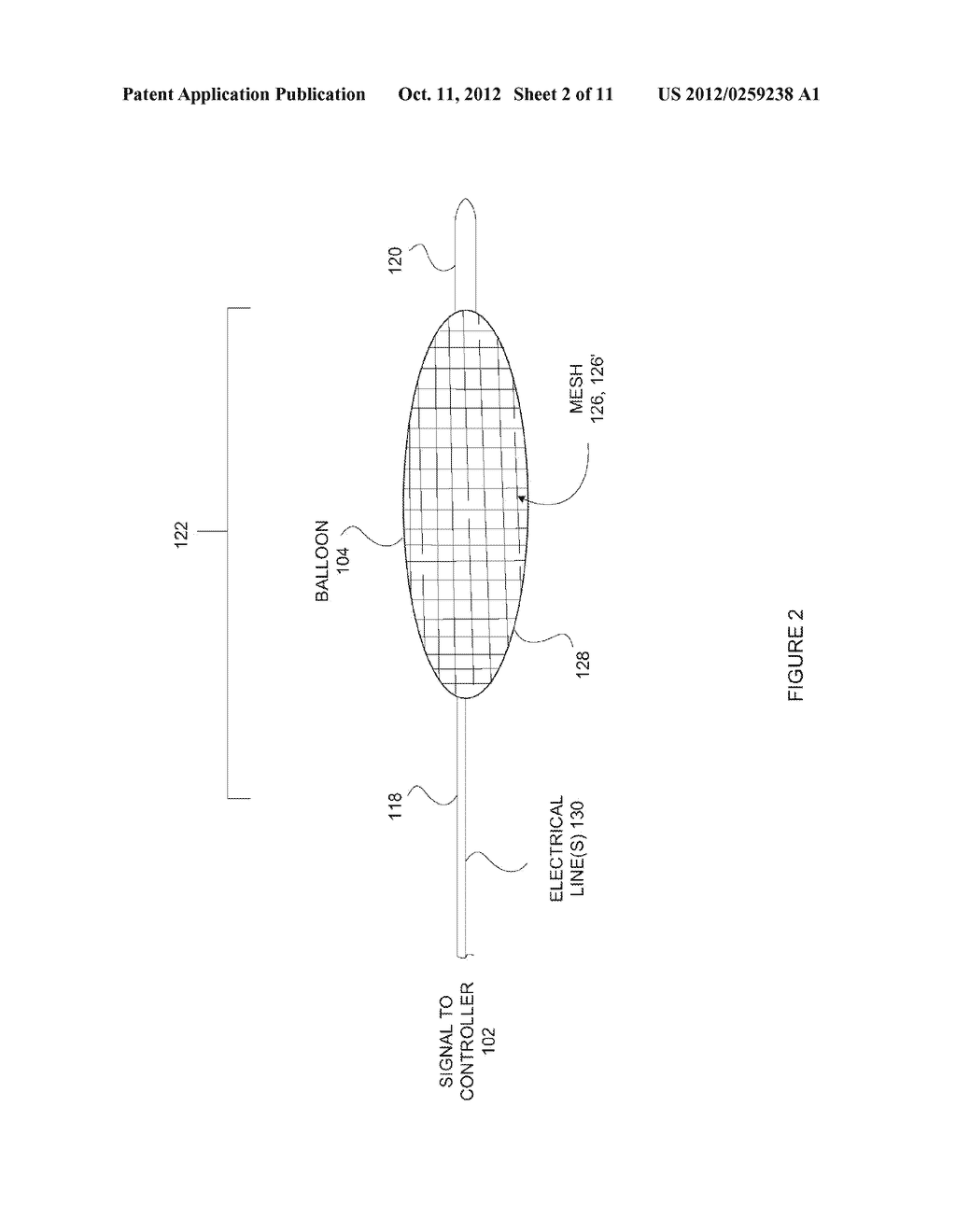 Anatomical Visualization With Electrically Conductive Balloon Catheter - diagram, schematic, and image 03