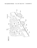 PUMPING SYSTEMS FOR CASSETTE-BASED DIALYSIS diagram and image