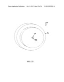 SAFETY NEEDLE ASSEMBLY WITH DISPLACEABLE LOCKING TONGUE diagram and image