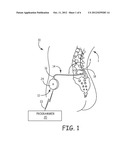 DETECTING FILL STATUS FOR MEDICAL PUMP RESERVOIR diagram and image