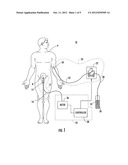 Kidney protection method diagram and image