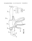 Laparoscopic Instrument with Attachable Energy End Effector diagram and image