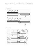 MEDICAL TREATMENT DEVICE diagram and image