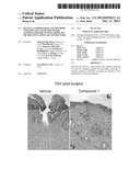 DEVICES, COMPOSITIONS AND METHODS UTILIZING EP4 AND EP2 RECEPTOR AGONISTS     FOR PREVENTING, REDUCING OR TREATING CAPSULAR CONTRACTURE diagram and image