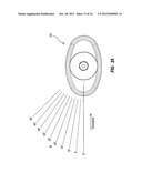 ARCHERY BOW STABILIZER APPARATUS diagram and image