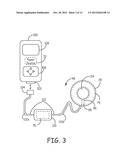 RECHARGE TUNING TECHNIQUES FOR AN IMPLANTABLE DEVICE diagram and image