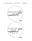 CAN END WITH STRENGTHENING BEAD CONFIGURATION diagram and image