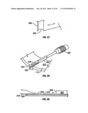 Method and apparatus using optical techniques to measure analyte levels diagram and image