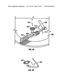 Method and apparatus using optical techniques to measure analyte levels diagram and image