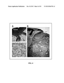 IDENTIFICATION AND TREATMENT OF CANCER SUBSETS diagram and image