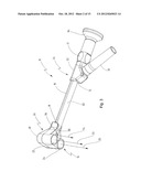 Exoscope diagram and image