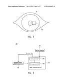 INTRAOCULAR PRESSURE DETECTING DEVICE AND DETECTING METHOD THEREOF diagram and image