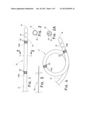 TUBULAR FEEDING DEVICE HAVING SHAPEABLE DISTAL END diagram and image