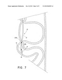 TUBULAR FEEDING DEVICE HAVING SHAPEABLE DISTAL END diagram and image