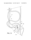 TUBULAR FEEDING DEVICE HAVING SHAPEABLE DISTAL END diagram and image